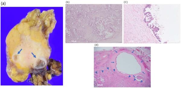 https://cdn.ncbi.nlm.nih.gov/pmc/blobs/34c2/9549872/1b152eaf0665/DEO2-3-e124-g001.jpg