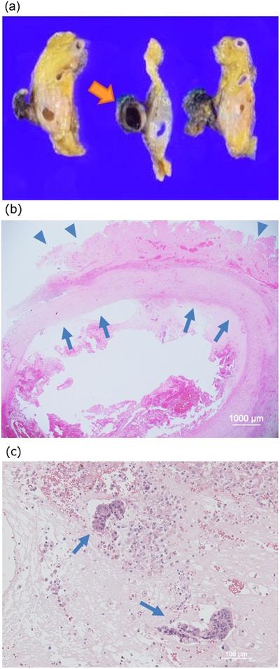 https://cdn.ncbi.nlm.nih.gov/pmc/blobs/34c2/9549872/48f143084476/DEO2-3-e124-g005.jpg