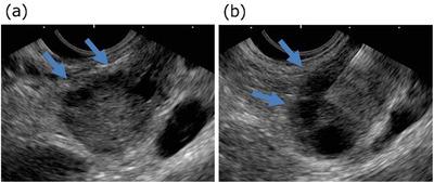 https://cdn.ncbi.nlm.nih.gov/pmc/blobs/34c2/9549872/5ba847062299/DEO2-3-e124-g002.jpg