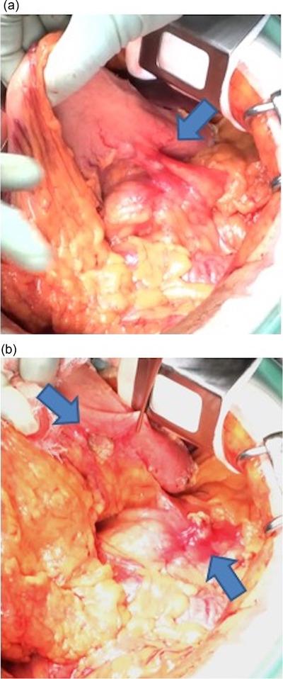 https://cdn.ncbi.nlm.nih.gov/pmc/blobs/34c2/9549872/a47d3385cd79/DEO2-3-e124-g003.jpg