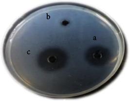 https://cdn.ncbi.nlm.nih.gov/pmc/blobs/34c4/11537737/798e01084643/IJMICRO2024-5306083.002.jpg