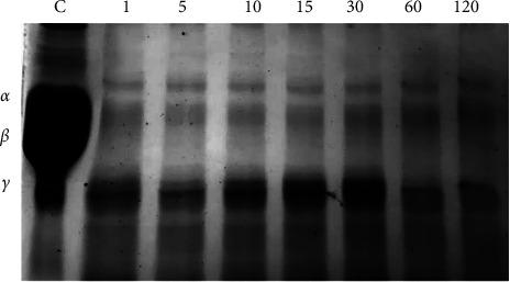 https://cdn.ncbi.nlm.nih.gov/pmc/blobs/34c4/11537737/8a3000d31616/IJMICRO2024-5306083.007.jpg