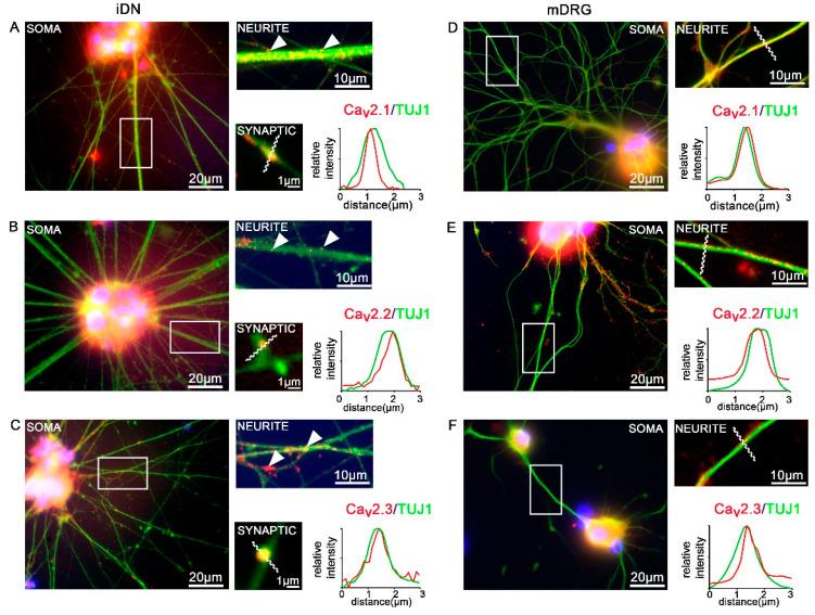 https://cdn.ncbi.nlm.nih.gov/pmc/blobs/34ce/7348931/59225ef155cf/brainsci-10-00344-g006.jpg