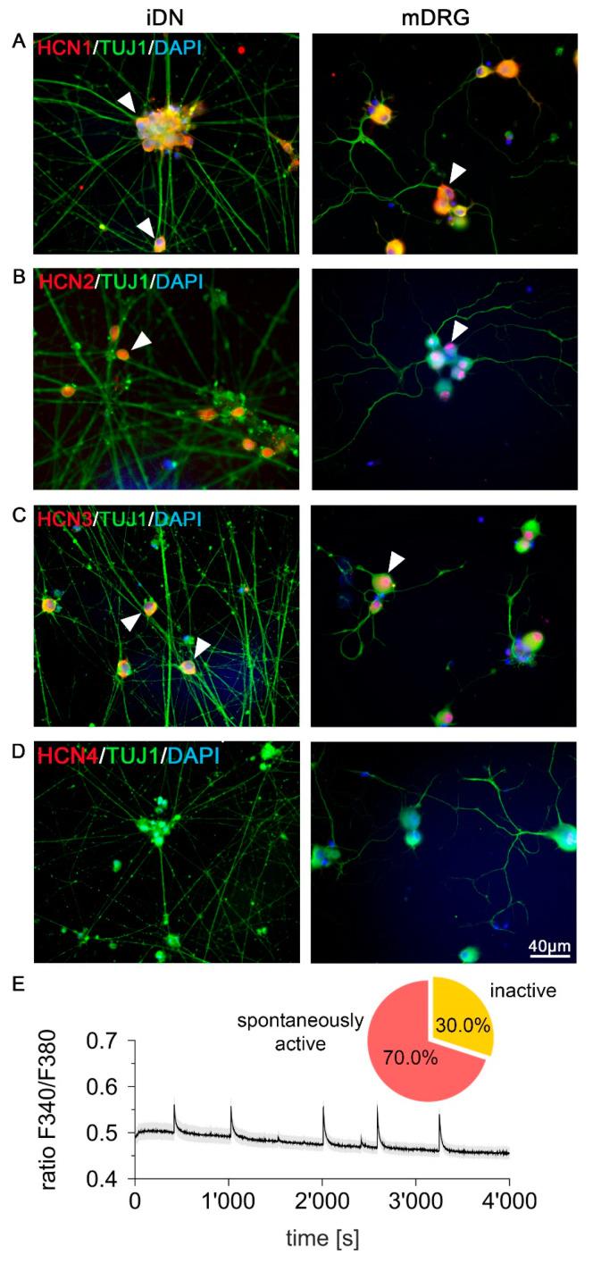 https://cdn.ncbi.nlm.nih.gov/pmc/blobs/34ce/7348931/bc77ca95f38b/brainsci-10-00344-g005.jpg