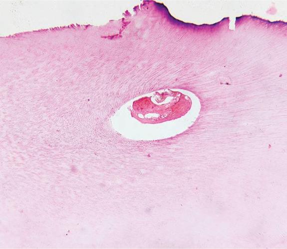 https://cdn.ncbi.nlm.nih.gov/pmc/blobs/34d7/8060928/18570b946ee9/ijcpd-13-729-g011.jpg