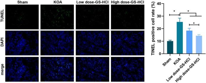 https://cdn.ncbi.nlm.nih.gov/pmc/blobs/34d8/12087291/334b74d06969/JCMM-29-e70579-g004.jpg