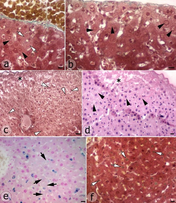https://cdn.ncbi.nlm.nih.gov/pmc/blobs/34d9/9590356/4db7a11527f6/CHSJ-48-02-146-fig2.jpg