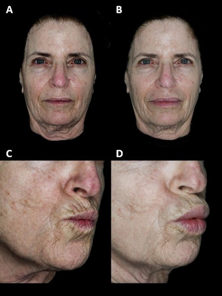 https://cdn.ncbi.nlm.nih.gov/pmc/blobs/34df/11407320/71bbcc37f1fa/CCID-17-2051-g0006.jpg