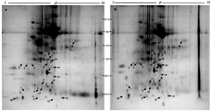 https://cdn.ncbi.nlm.nih.gov/pmc/blobs/34e1/5217371/1a03c18f01e2/proteomes-04-00009-g001.jpg