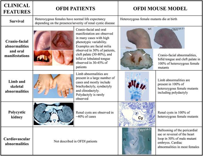 https://cdn.ncbi.nlm.nih.gov/pmc/blobs/34e4/9303915/bb4c303d4655/AJMG-190-57-g002.jpg