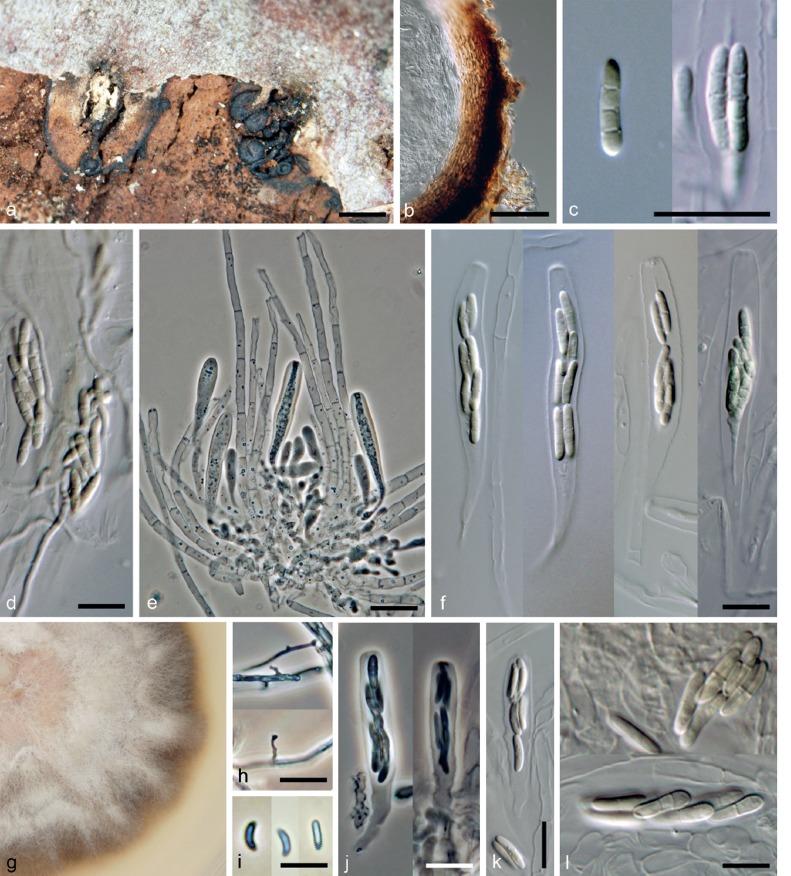 https://cdn.ncbi.nlm.nih.gov/pmc/blobs/34e7/4713105/8ff70c2a66fc/per-35-021-g010.jpg
