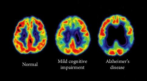 https://cdn.ncbi.nlm.nih.gov/pmc/blobs/34e9/12256179/c32cbb6748ec/IJBM2025-4557622.005.jpg