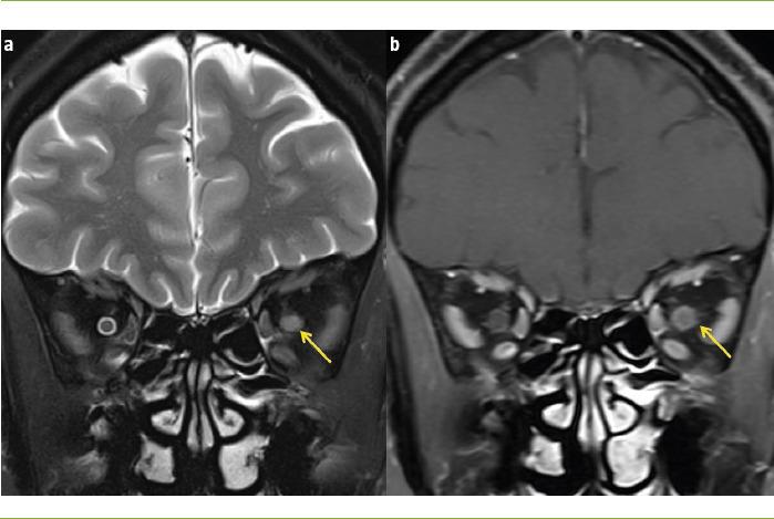 https://cdn.ncbi.nlm.nih.gov/pmc/blobs/34ec/11500035/2915c2fe52b6/RN-74-93-g001.jpg