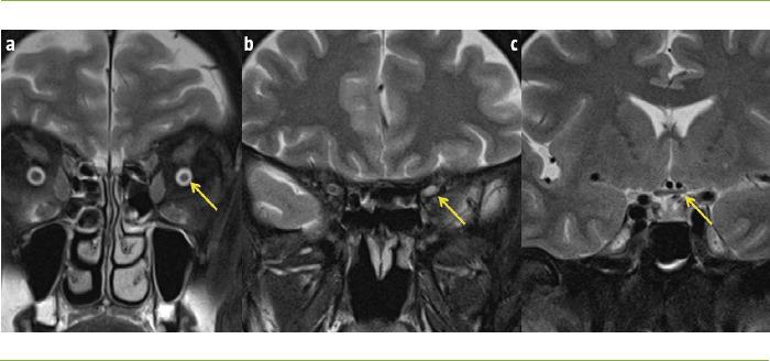 https://cdn.ncbi.nlm.nih.gov/pmc/blobs/34ec/11500035/ee960934c4c0/RN-74-93-g002.jpg