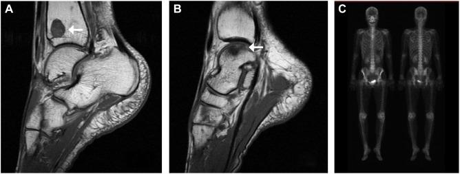 https://cdn.ncbi.nlm.nih.gov/pmc/blobs/34ef/4778786/dcb9bedf3ee9/ott-9-1029Fig2.jpg