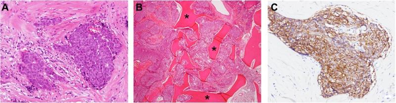https://cdn.ncbi.nlm.nih.gov/pmc/blobs/34ef/4778786/fcc07b281f11/ott-9-1029Fig1.jpg
