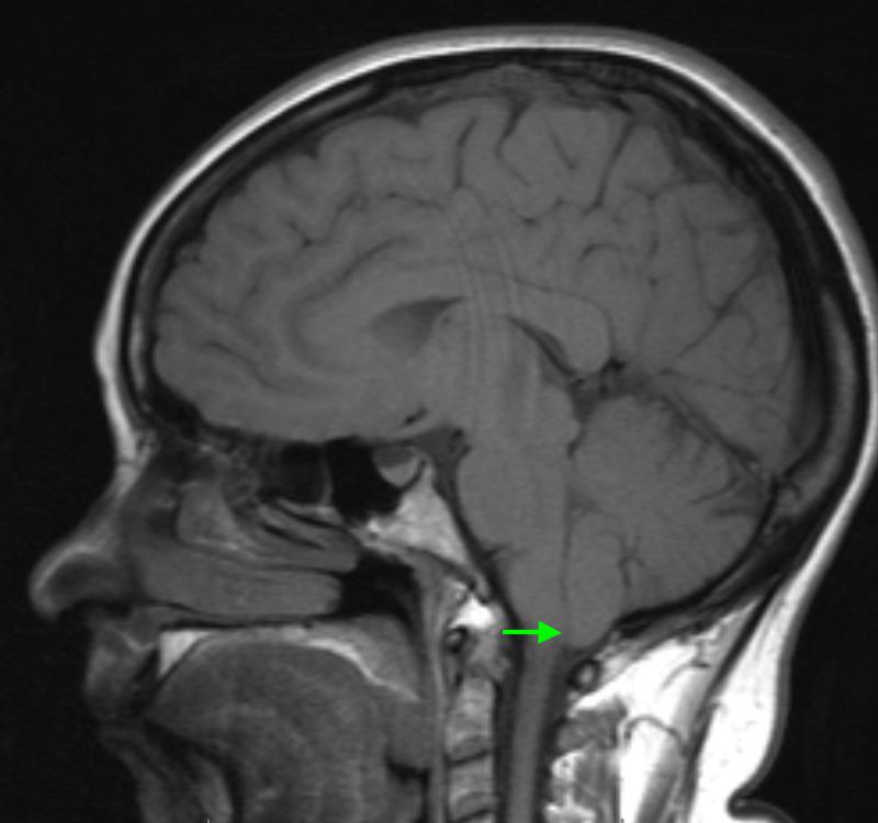 https://cdn.ncbi.nlm.nih.gov/pmc/blobs/34ef/7899279/5743f74dd2d1/cureus-0013-00000012871-i01.jpg