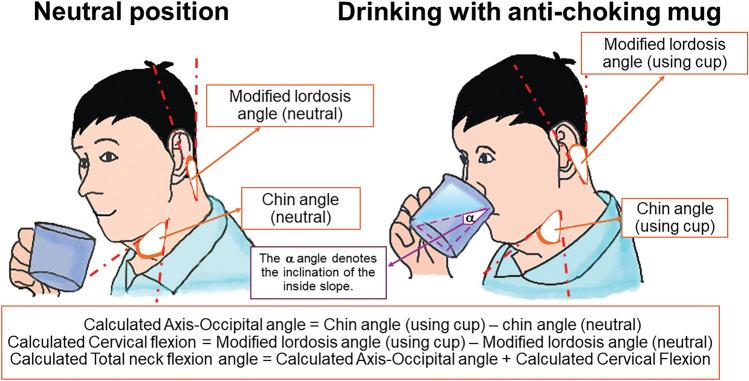 https://cdn.ncbi.nlm.nih.gov/pmc/blobs/34f4/11187143/efcfb6597cf5/41598_2024_65071_Fig4_HTML.jpg