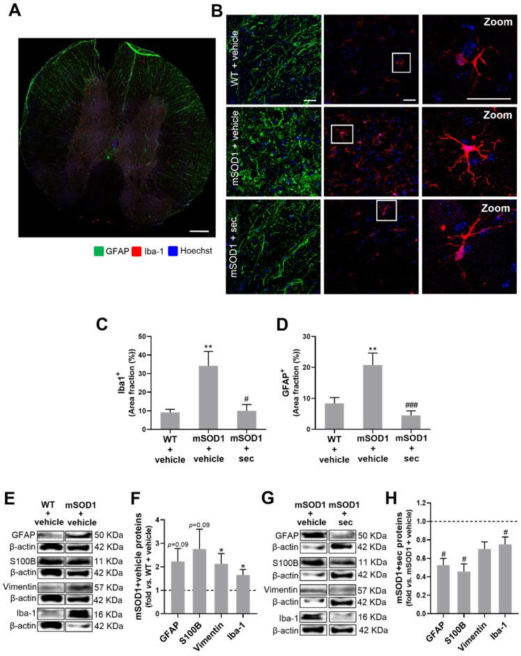 https://cdn.ncbi.nlm.nih.gov/pmc/blobs/3502/9496075/e6defb13dccd/biomedicines-10-02120-g009.jpg