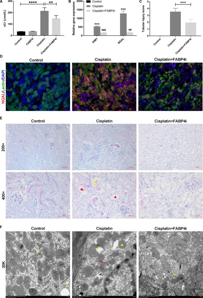 https://cdn.ncbi.nlm.nih.gov/pmc/blobs/3508/6714212/639646707806/JCMM-23-6260-g001.jpg