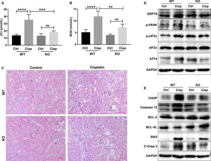 https://cdn.ncbi.nlm.nih.gov/pmc/blobs/3508/6714212/fbbee68c8338/JCMM-23-6260-g005.jpg