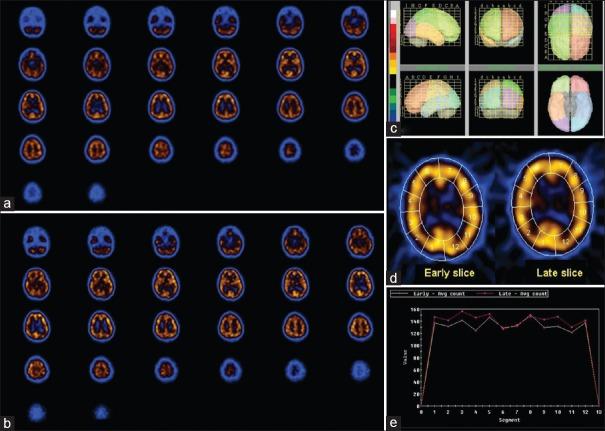 https://cdn.ncbi.nlm.nih.gov/pmc/blobs/350f/6380134/b8ea3d7f335a/JPGM-65-33-g001.jpg