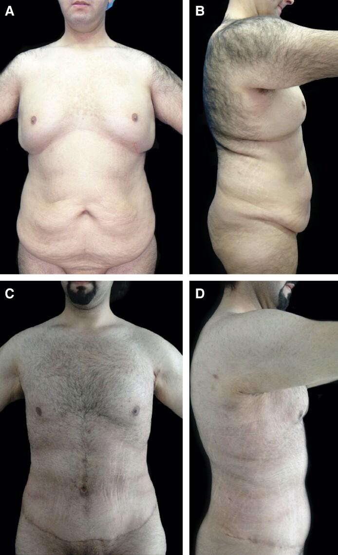 https://cdn.ncbi.nlm.nih.gov/pmc/blobs/3510/11997773/7faf44f2213b/ojae118f7.jpg