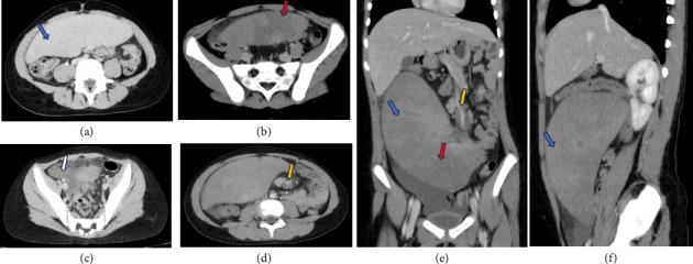 https://cdn.ncbi.nlm.nih.gov/pmc/blobs/3514/12349995/c4e02d090b94/CRIPE2025-9927034.001.jpg