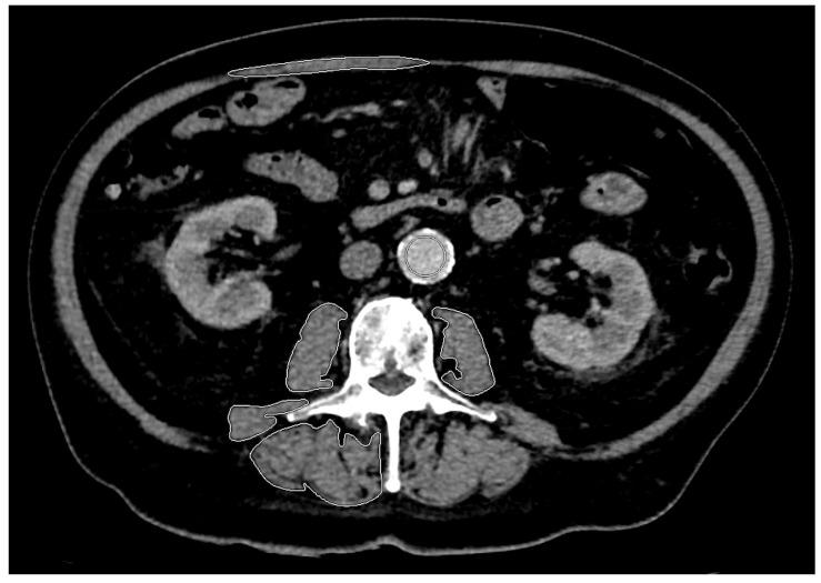 https://cdn.ncbi.nlm.nih.gov/pmc/blobs/3519/10814393/05b58bcd953c/diagnostics-14-00198-g002.jpg