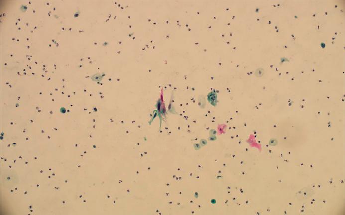 https://cdn.ncbi.nlm.nih.gov/pmc/blobs/351a/12283066/dff1a1cf5484/acy-2025-0000-0000-546947_F07.jpg