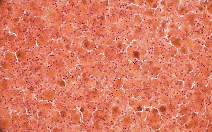 https://cdn.ncbi.nlm.nih.gov/pmc/blobs/351a/12283066/e08e9da6c55e/acy-2025-0000-0000-546947_F04.jpg