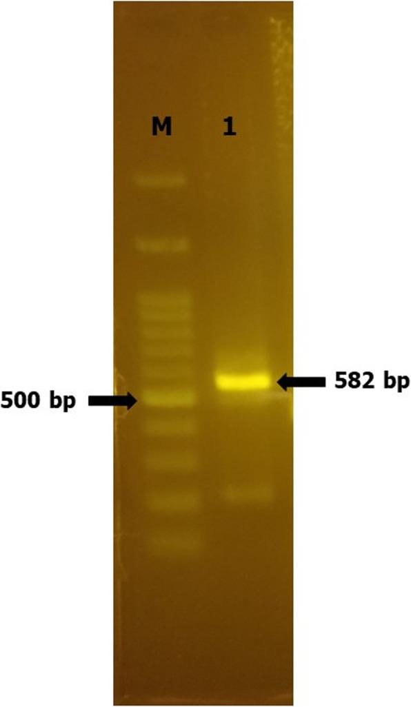 https://cdn.ncbi.nlm.nih.gov/pmc/blobs/3523/7796619/2587bdc11627/12917_2020_2719_Fig1_HTML.jpg