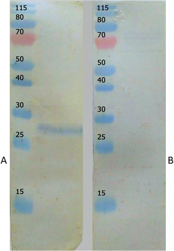 https://cdn.ncbi.nlm.nih.gov/pmc/blobs/3523/7796619/32d936c1f787/12917_2020_2719_Fig4_HTML.jpg