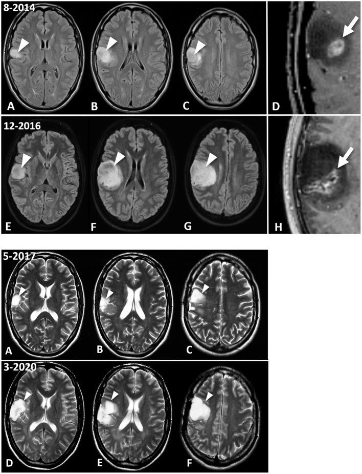 https://cdn.ncbi.nlm.nih.gov/pmc/blobs/352f/8200410/085b3f18db22/fnut-08-682243-g0001.jpg