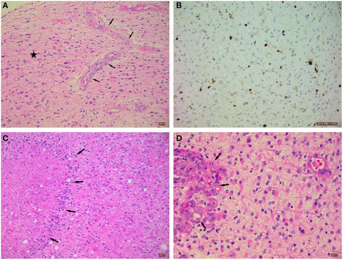 https://cdn.ncbi.nlm.nih.gov/pmc/blobs/352f/8200410/f84ba3967290/fnut-08-682243-g0002.jpg