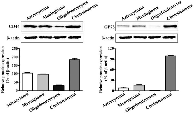 https://cdn.ncbi.nlm.nih.gov/pmc/blobs/3534/5835860/99897e1f2557/ol-15-04-4958-g01.jpg
