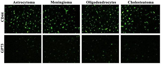 https://cdn.ncbi.nlm.nih.gov/pmc/blobs/3534/5835860/ffe5c24e4bb2/ol-15-04-4958-g03.jpg