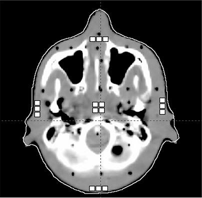 https://cdn.ncbi.nlm.nih.gov/pmc/blobs/3539/5719770/e68a63691ce9/ACM2-11-229-g001.jpg