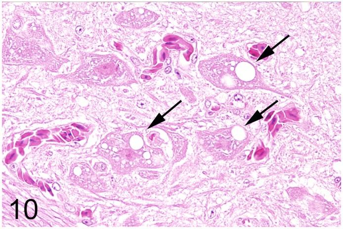 https://cdn.ncbi.nlm.nih.gov/pmc/blobs/353f/5389639/94a939f085c5/pone.0173873.g010.jpg