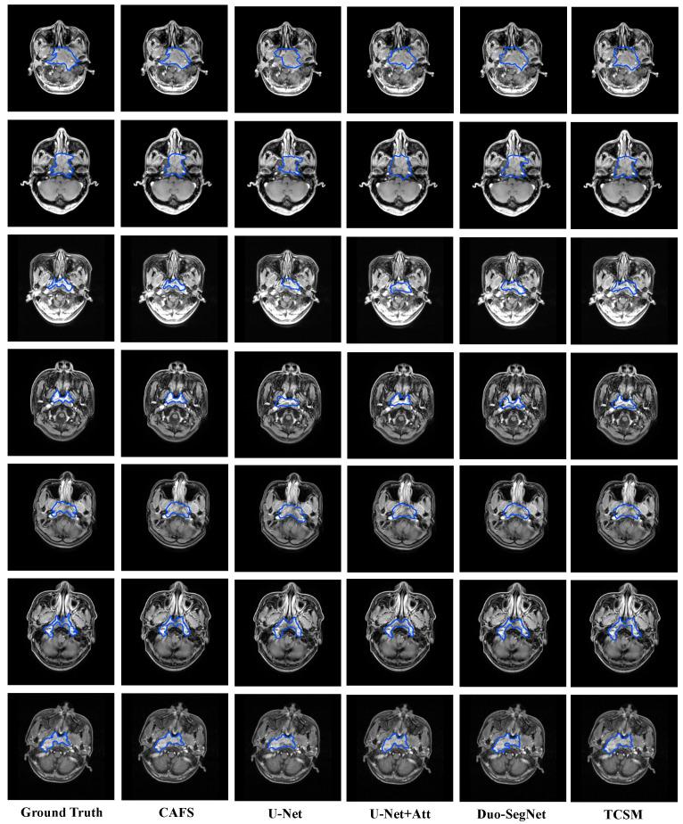 https://cdn.ncbi.nlm.nih.gov/pmc/blobs/3540/9269783/f9ee9d8d2399/sensors-22-05053-g003.jpg