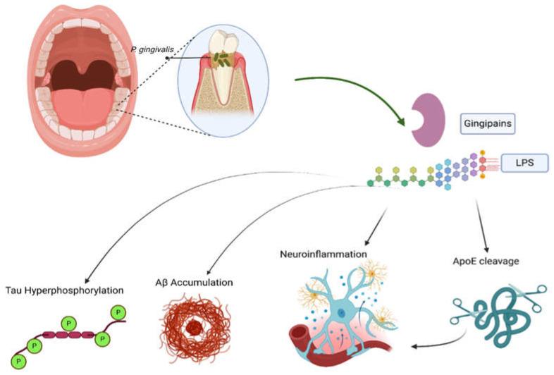 https://cdn.ncbi.nlm.nih.gov/pmc/blobs/3541/12196369/25e0aa84833f/neurolint-17-00081-g003.jpg