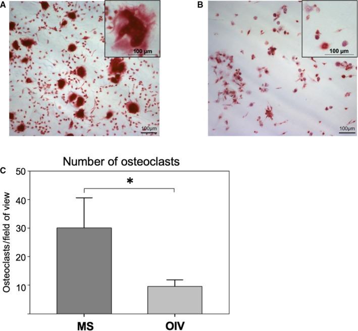 https://cdn.ncbi.nlm.nih.gov/pmc/blobs/3543/7214153/381b9483cf09/JCMM-24-5665-g003.jpg