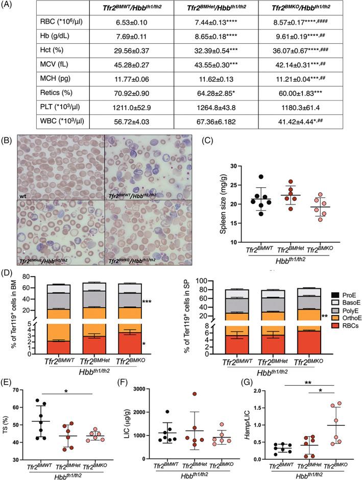 https://cdn.ncbi.nlm.nih.gov/pmc/blobs/354a/9540808/ba071c26a358/AJH-97-1324-g004.jpg