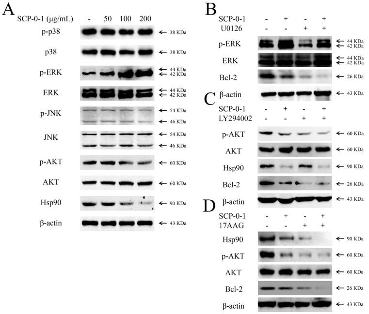 https://cdn.ncbi.nlm.nih.gov/pmc/blobs/354d/4964391/4eb2c7aa04e7/ijms-17-01015-g005.jpg