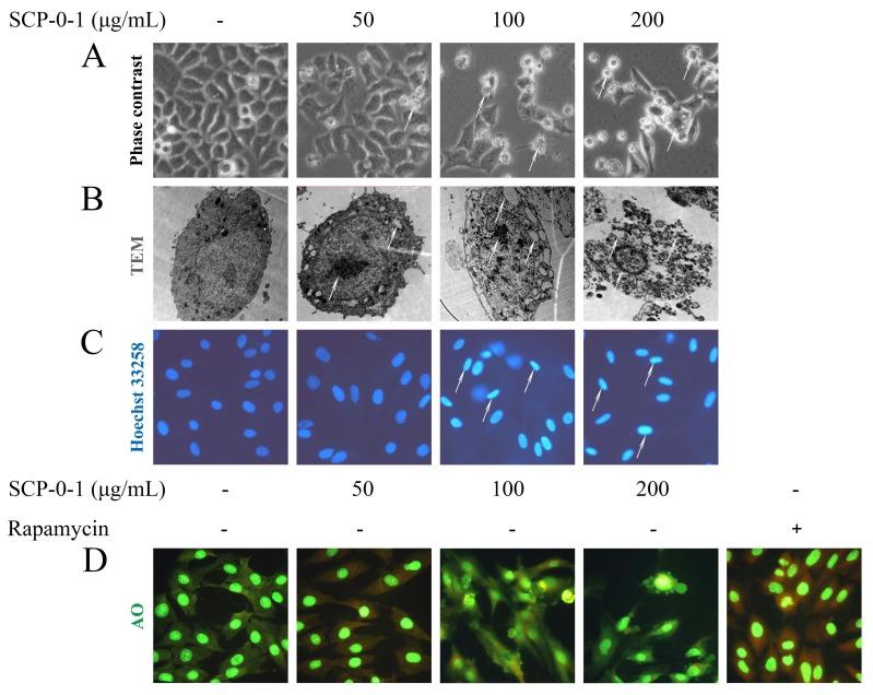 https://cdn.ncbi.nlm.nih.gov/pmc/blobs/354d/4964391/a17779889a99/ijms-17-01015-g003.jpg