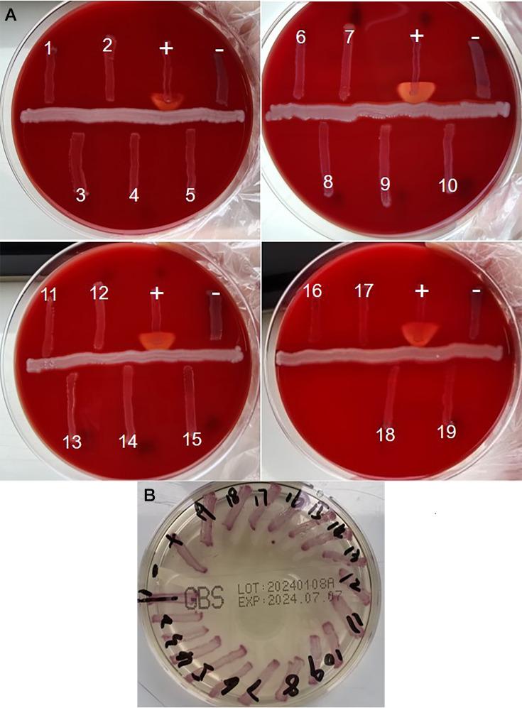 https://cdn.ncbi.nlm.nih.gov/pmc/blobs/3551/12054153/b5f0a8e6efa2/spectrum.03257-24.f001.jpg