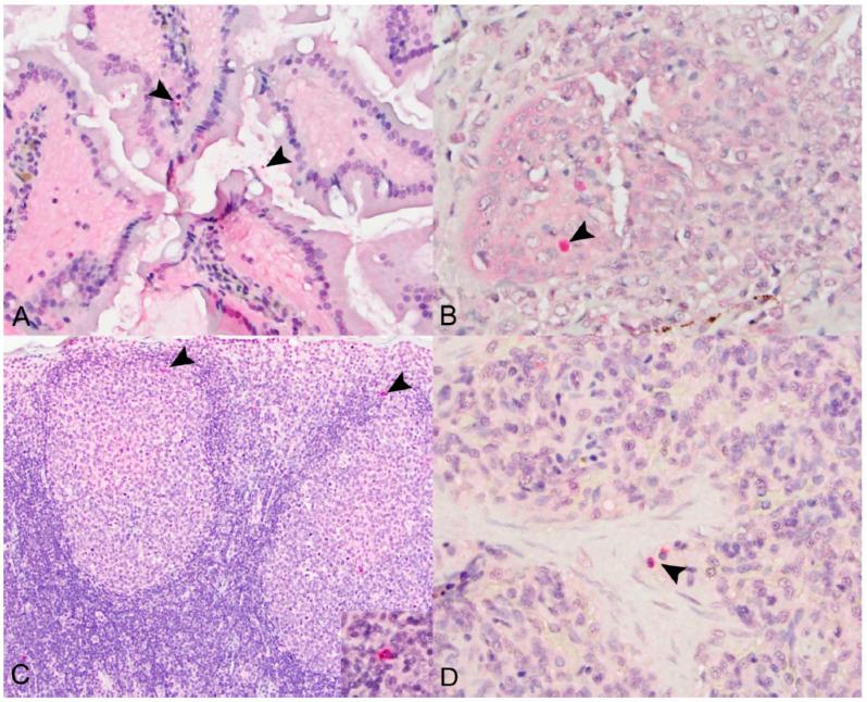 https://cdn.ncbi.nlm.nih.gov/pmc/blobs/3553/9227259/d68aef949b55/viruses-14-01278-g004.jpg