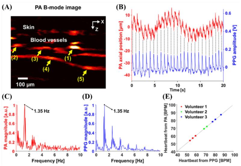 https://cdn.ncbi.nlm.nih.gov/pmc/blobs/355b/9775951/50968c3a995f/biosensors-12-01154-g006.jpg