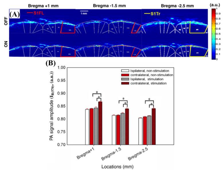 https://cdn.ncbi.nlm.nih.gov/pmc/blobs/355b/9775951/e7df90b6fc25/biosensors-12-01154-g023.jpg