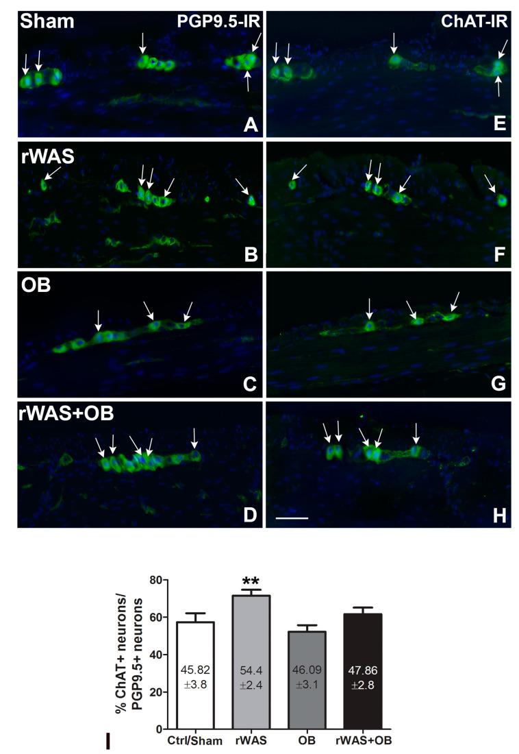 https://cdn.ncbi.nlm.nih.gov/pmc/blobs/355f/10139220/2b56ae588dfa/ijms-24-07440-g004.jpg